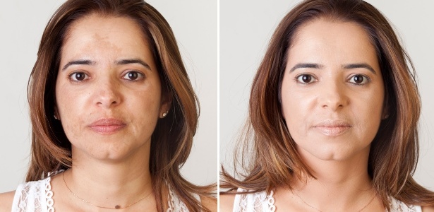 A gestora financeira Cláudia Queiroz sem maquiagem e com manchas e depois, já maquiada e com a pele uniforme