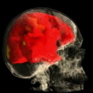 Imagens neurais simulam atuação do cérebro durante o orgasmo
