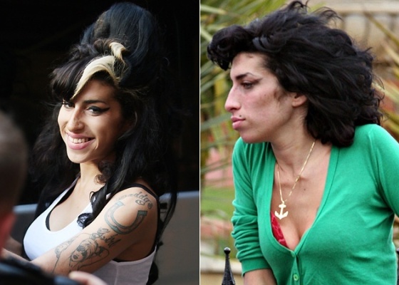 A cantora Amy Winehouse depois (10/10/2009) e antes (27/3/2009) da cirurgia de implante de silicone em outubro de 2009