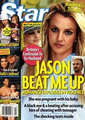 Capa da revista Star mostra a cantora Britney Spears com um olho roxo que poderia ter sido resultado de uma briga com seu namorado, Jason Trawick (1/12/2010)