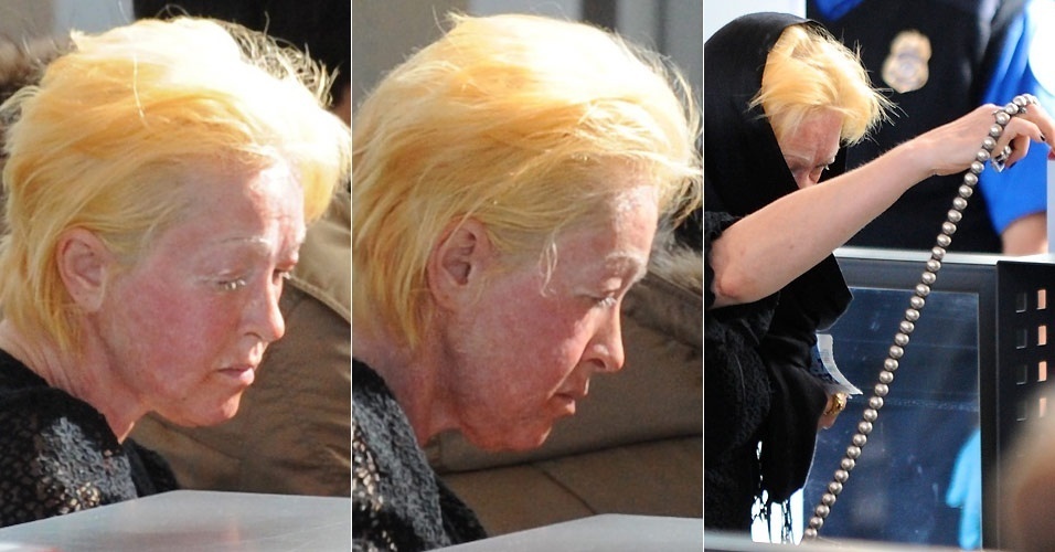Com o rosto vermelho e a pele bastante irritada, a cantora Cyndi Lauper embarca no aeroporto de Los Angeles (31/1/2011)