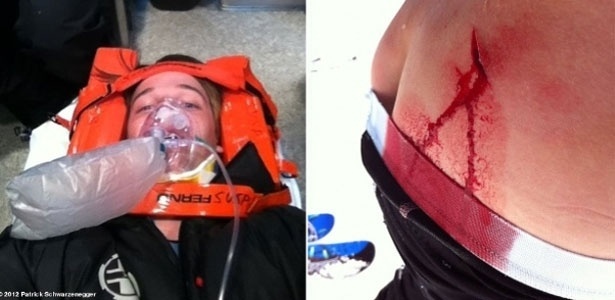 Filho de Arnold Schwarzenegger, Patrick Schwarzenegger, publica foto dele próprio sendo levado a hospital, após levar tombo de esqui (10/3/12)
