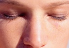 Cuidados evitam doenças típicas do calor, como micose, alergia e intoxicação - Getty Images
